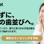 SmileSetアイキャッチ画像